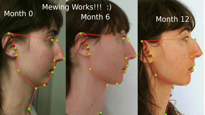 Where To Place Tongue While Mewing What Is Mewing Slang