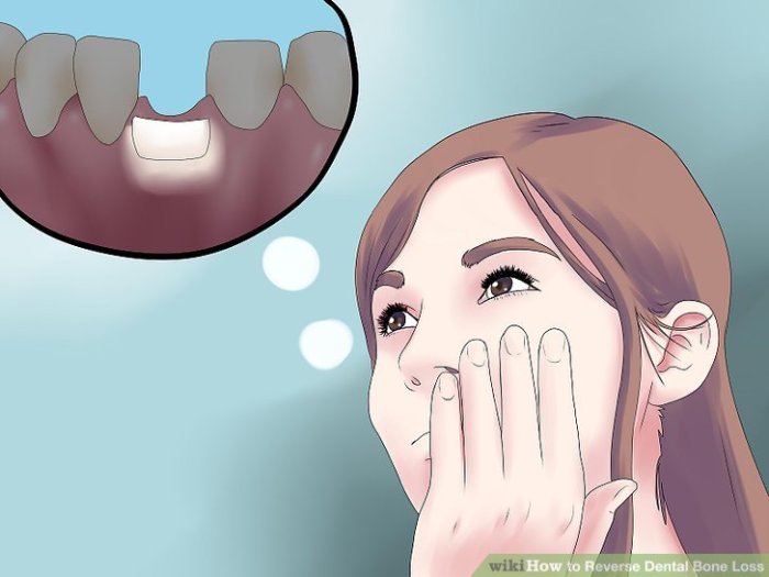 Reverse Dental Bone Loss Understanding the Reversal