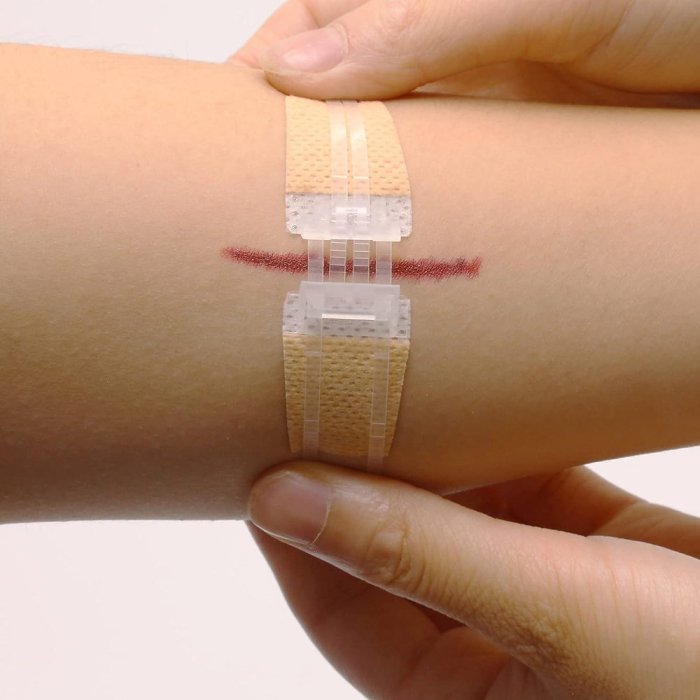 How to Apply a Butterfly Bandage: With Visual Instructions! Apply a Butterfly Bandage