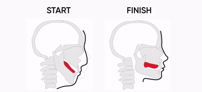 MEWING Tongue Posture | Train Your Tongue to Attach to Your Mouth - YouTube What Is Mewing Slang