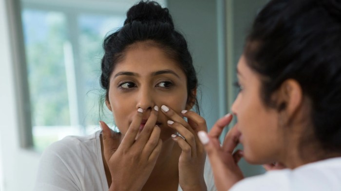 Expert Brings a Pimple to the Surface
