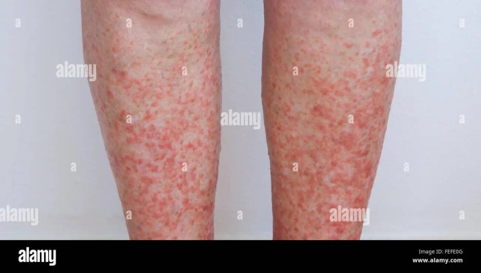 What Causes Itchy Legs